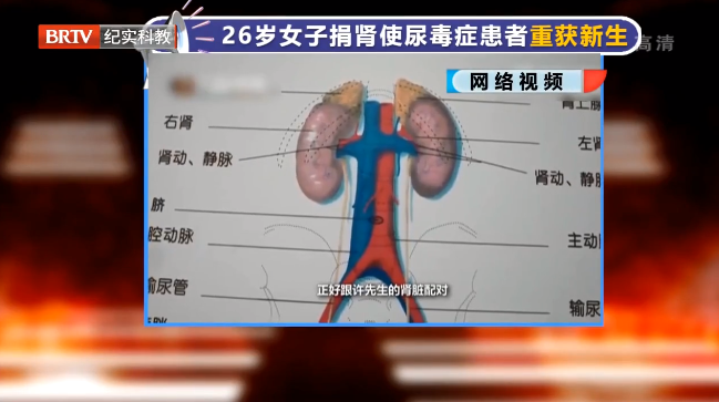 大愛無言！26歲女子捐腎使尿毒癥患者重獲新生，關(guān)于遺體捐獻(xiàn)，看看法律怎么說？