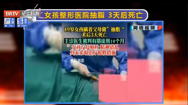 京云律師解讀：19歲女孩整形醫(yī)院抽脂后3天死亡，主診醫(yī)生獲刑！